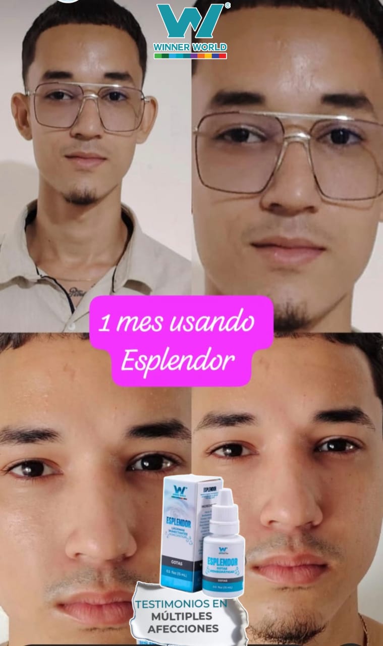 Gotas Esplendor – Lágrimas Humectantes Homeopáticas para el Cuidado Visual