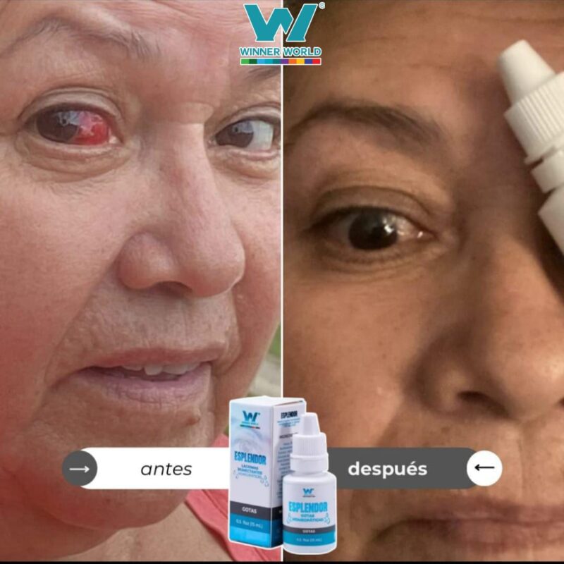 Gotas Esplendor – Lágrimas Humectantes Homeopáticas para el Cuidado Visual