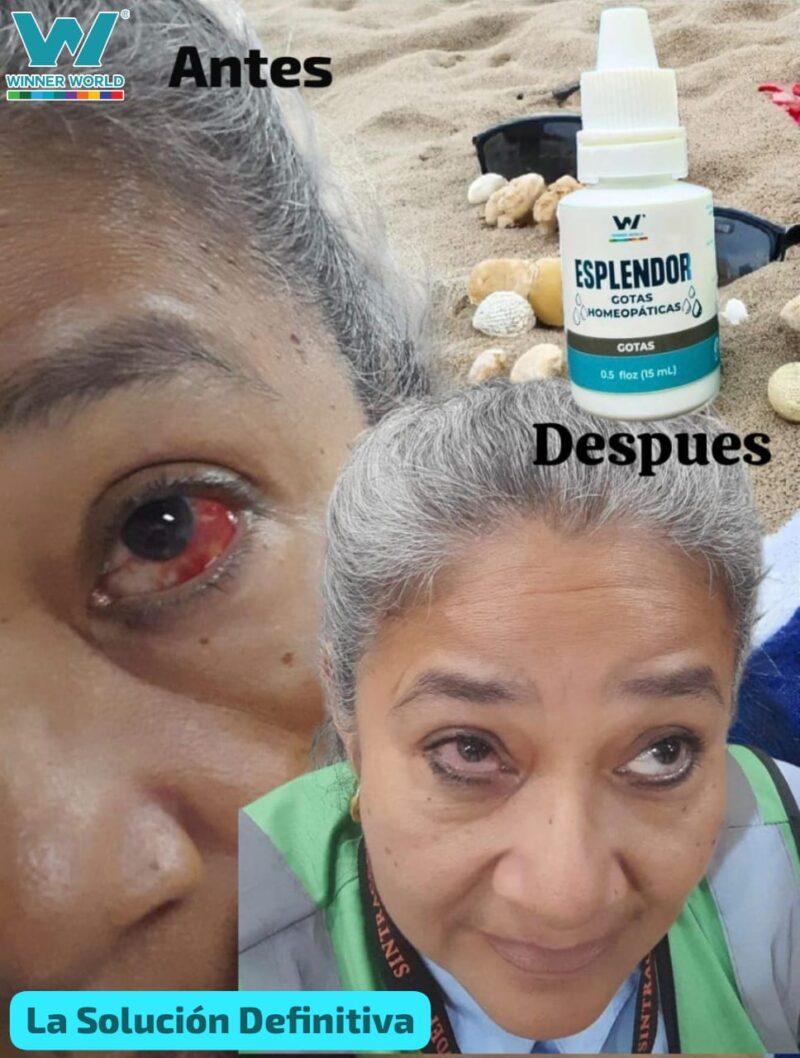 Gotas Esplendor – Lágrimas Humectantes Homeopáticas para el Cuidado Visual